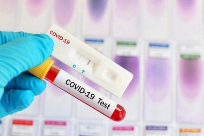 Гърция ще допуска български граждани и с отрицателен бърз антигенен тест на хартиен носител
